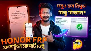 Honor FRP Unlock All Models 2026 | FRP Key By SN/IMEI [Android 15/16] Latest Security Supported