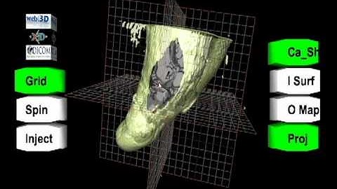 Extensible 3D (X3D) Volume Rendering