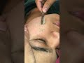 Derma planing #skincare #asmr #shorts #dermatology