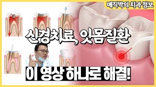 매직박의 신경치료와 잇몸질환 상담 하이라이트