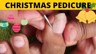 Ingrown Toenails Treatment-Alma's Manicure and Pedicure Vlogs-Joyful Initial Result