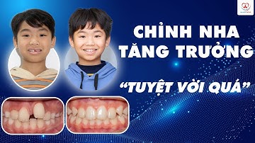 Khắc Phục Răng Khấp Khểnh Với Chỉnh Nha Tăng Trưởng Cho Trẻ | Bác sĩ Thu Gia Lâm