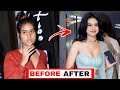 Bollywood Actresses Surgery Before And After | Bollywood Actress With Plastic Surgery | Nysa Devgan