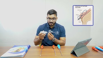 All About Suture Anchors: Orthopedic Surgery Guide | Zealmax Ortho