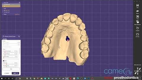 Exocad 3.0 Galway - How to Make Models from Trios Scans Presented by Boise Prosthodontics