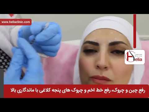 تصویری: تزریق بوتاکس تا 40 سالگی: جوانب مثبت و منفی