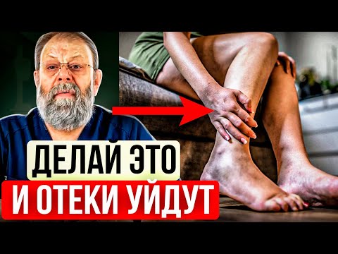 ОТЁКИ НОГ ПРОЙДУТ! Как убрать ОТЁКИ? Причины Отёков.