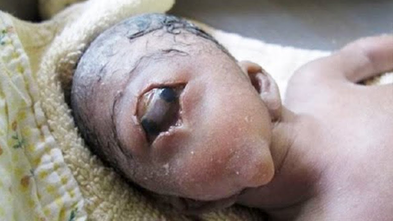 עשר הילדים הכי מוזרים בעולם| טופטן