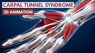 Carpal Tunnel Syndrome l 3D Animation