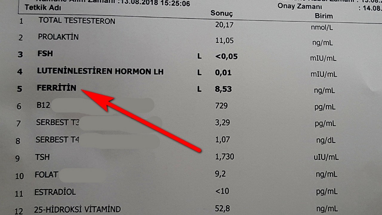 KALSİYUM YÜKSEKLİĞİ NEDEN OLUR ?