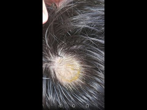 Video: Alopecija Nakon Postripa I Loš Rast Dlake Kod Kućnih Ljubimaca