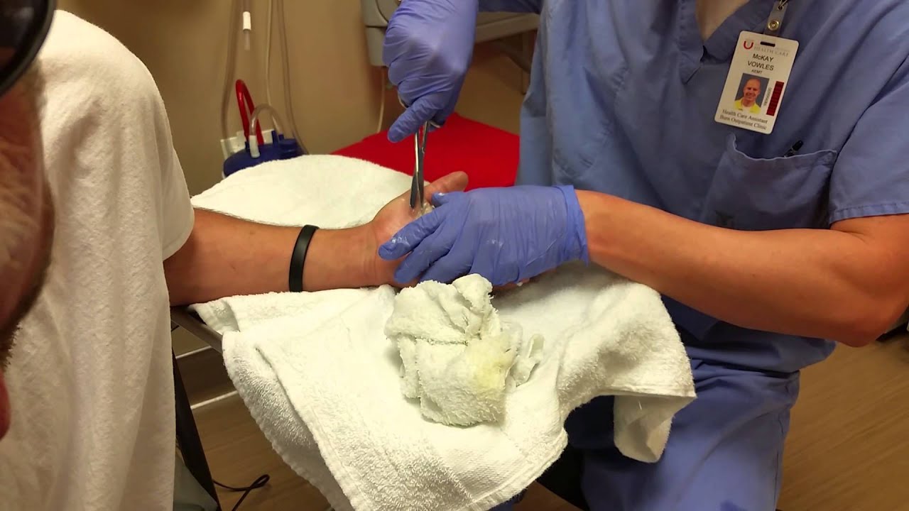 Blister Pop YouTube