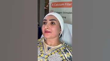 Calcium Fillers For Neck And Around Mouth فيلر كالسيوم للرقبة وحول الفم Skincare Beauty 