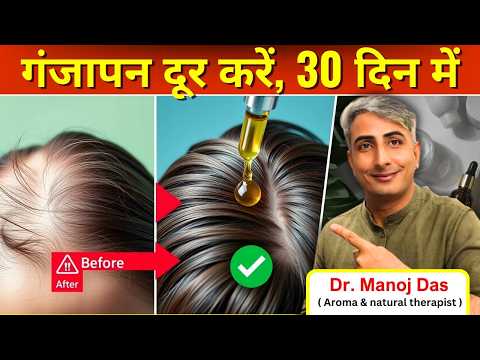 गंजापन दूर करें I 7 दिन में बालों का झड़ना बंद I नई ग्रोथ शुरू! 😱 I DR. MANOJ DAS #drmanojdas