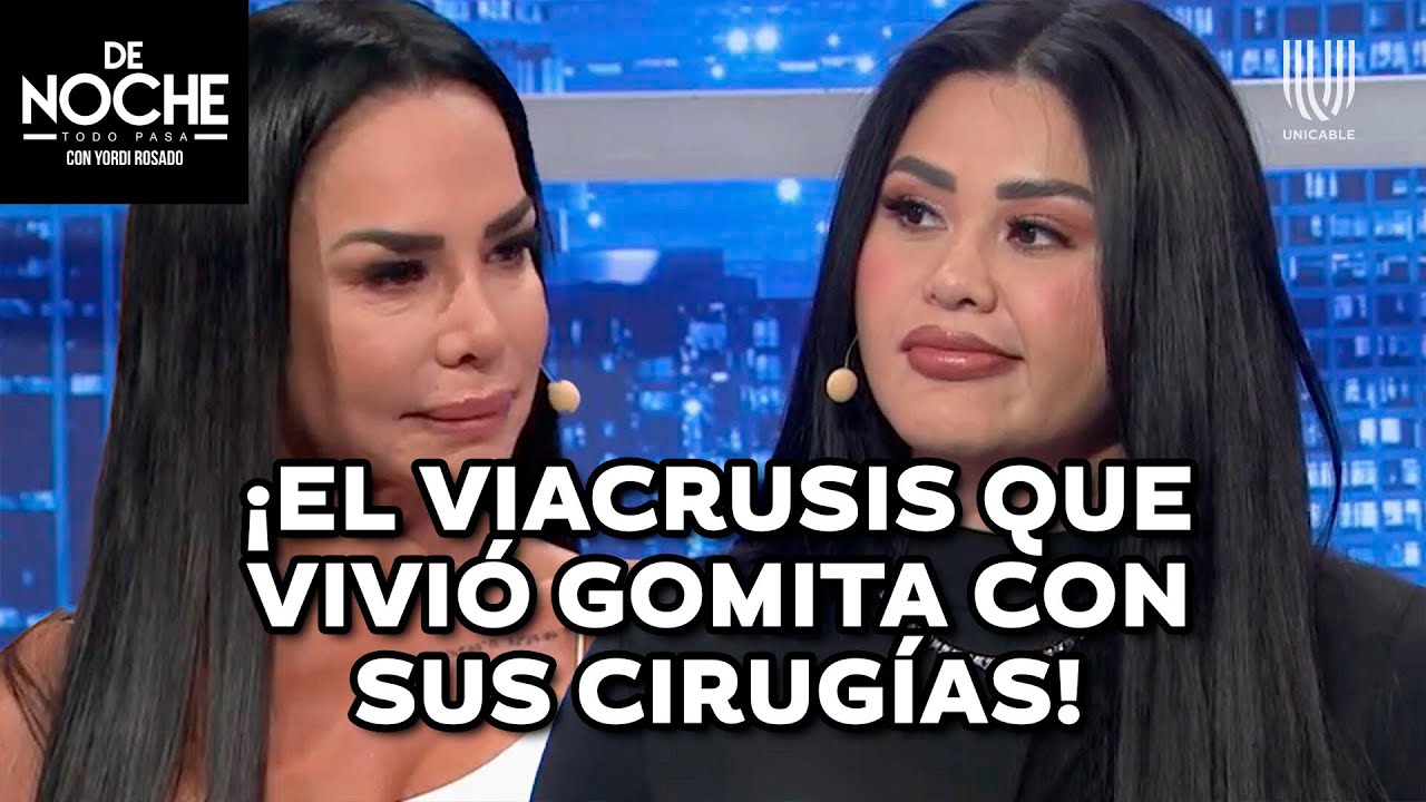 ¡Gomita reveló la la triste razón por la que se sometió a tantas cirugías estéticas! | De Noche
