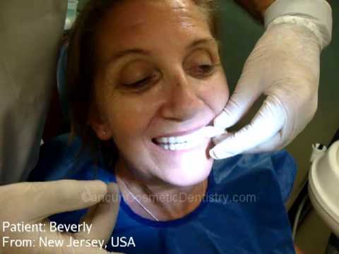Hookup A Guy With Deceptive Teeth Hookup A Guy With Counterfeited Teeth