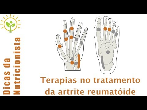 Vídeo: Tratamento Ayurvédico Da Artrite Reumatóide: Como Funciona
