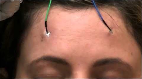 PressOn™ EEG Electrode