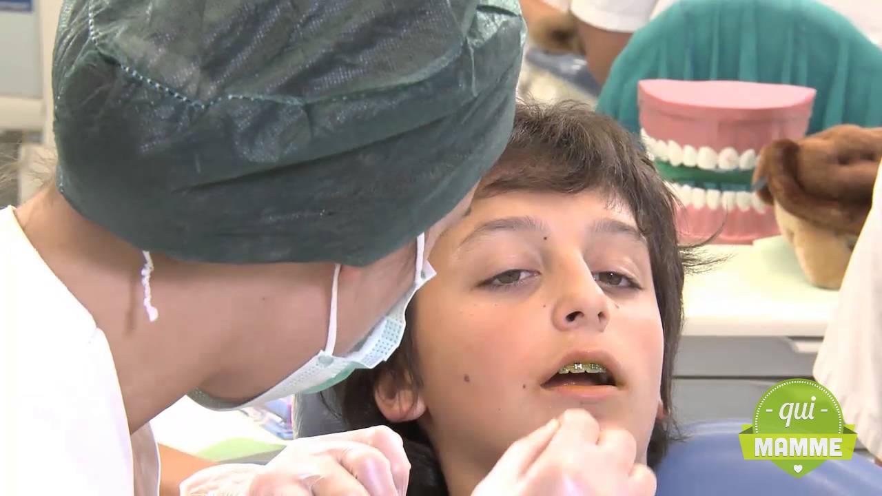 Bambini con l'apparecchio: come pulire i denti