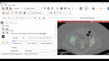 3D Slicer: Editing a 3D segment