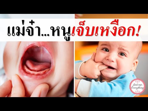 อาการทารก : แม่จ๋า...หนูเจ็บเหงือก! | ทารกคันเหงือก | เด็กทารก Everything