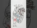 Cardiologist vs Surgeon Who Fixes Your Heart #heartdoctor #surgeon #cardiology #explainedinshorts