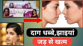 Scar Clear Cream Uses In Hindi | ऐसी आयुर्वेदिक क्रीम जो बिना साइड इफेक्ट के चेहरा साफ करेगी।