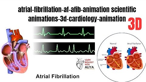 atrial fibrillation-af afib animation | scientific animations 3d | cardiology animation | 3d video