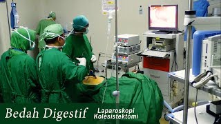 OPEN CHOLESISTECTOMY by DWIJA PUTRA, DIGESTIVE CONSULTANT ❤️