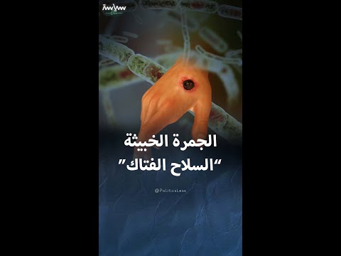 عندما تحولت الجمرة الخبيثة من مرض إلى سلاح بيولوجي