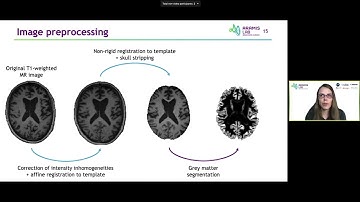 OHBM 2020 | Educational Course  | Machine Learning for NeuroImaging, learn the basics be… | Part 3