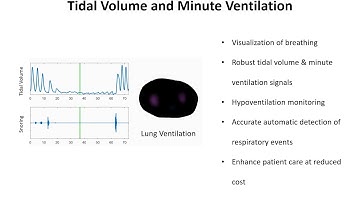 Noninvasive Continuous Monitoring of Tidal Volume and Minute Ventilation