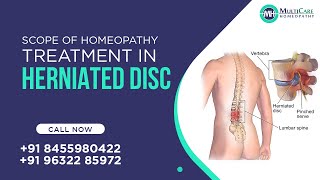 Scope of Homeopathy Treatment in Herniated Disc