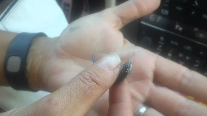 Oh Shit He Bit Me