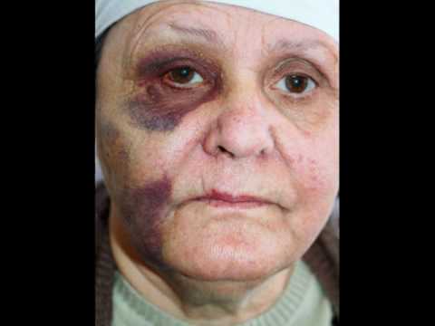 psa Brody rose elder abuse