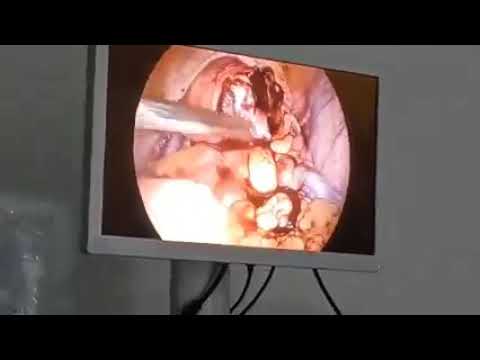 Clinical video 12 thumbnail
