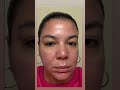 Clear skin isn’t luck. It’s intention + the right regimen!