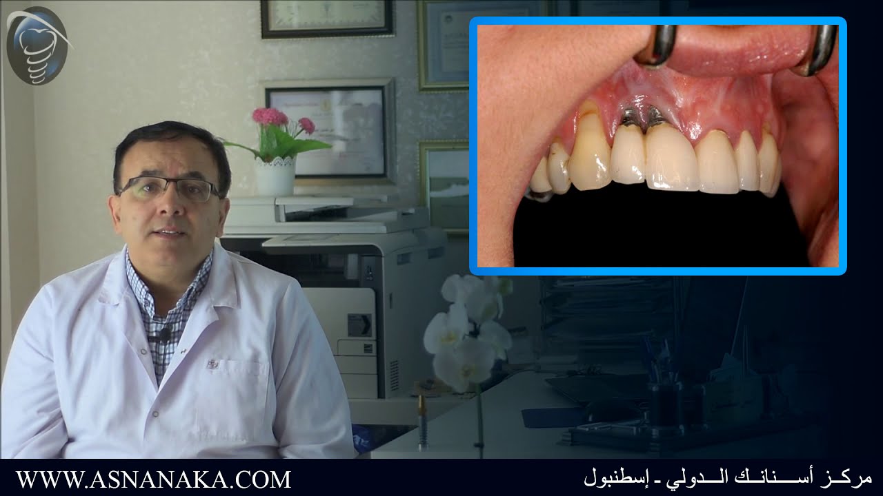 أنطباعات مراجع من المدينة المنورة حول زراعة الأسنان في مركز أسنانك الدولي في اسطنبول Youtube