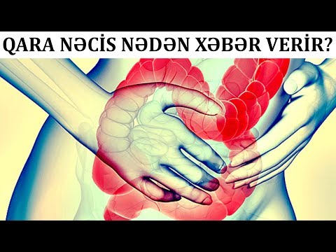 Video: Bir Uşağa Nəcis Necə Gətirir