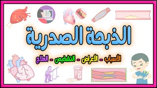 ما هي الذبحة الصدرية ؟ الأسباب - الأعراض - طرق العلاج و المزيد