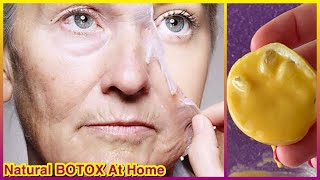 Herkes Yüzünüze Gençlik Aşısı Yaptığınızı Sanacak !Evde YÜZ GERME ! Doğal BOTOX Maskesi