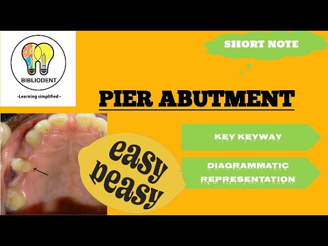 Video: Pier abutment nyob qhov twg?