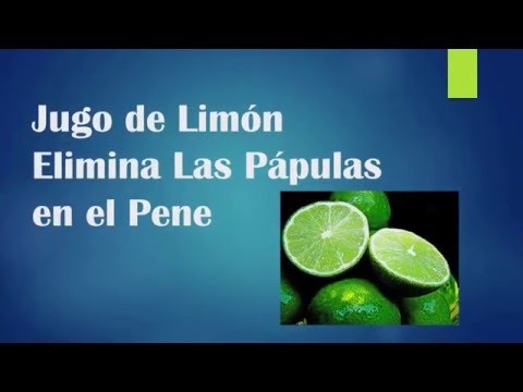 papulas perladas en el glande Jugo de Limon Elimina Las Papulas en el Pene