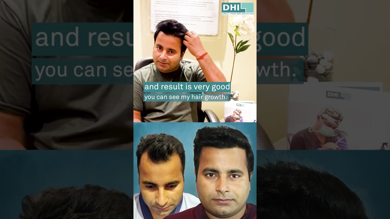 Trust In The Best | DHI Hair Transplant Experience | DHI