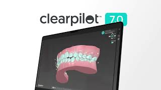 ClearPilot 7.0 | More Control Over Your Treatment Plans