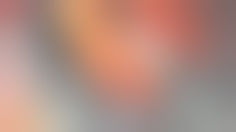 IFIS i.e. Intraoperative Floppy Iris Syndrome  - Pradip Mohanta