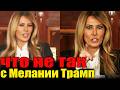 Скандал года Всплыла вся правда о Мелании Трамп Она Жертва или хищница