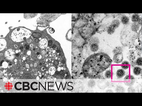 What specialists know about Omicron subvariant BA.2