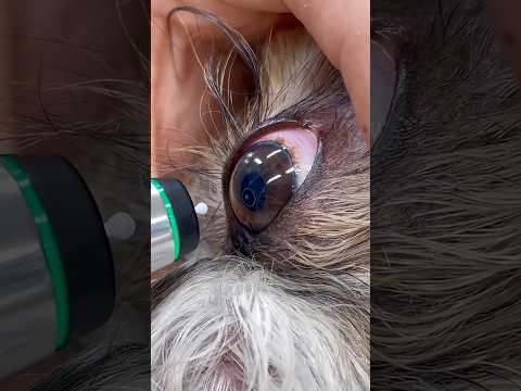 This Test Can Protect Your Vision