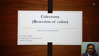 Colectomy